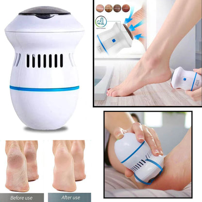 Electric Foot Grinder Callus Remover